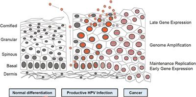 Correlation between human papillomavirus viral load and cervical lesions classification: A review of current research